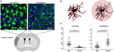 Automated Morphological Analysis of Microglia After Stroke